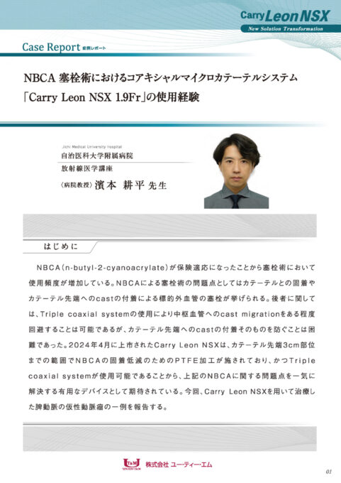 Carry Leon NSX|カテーテル・マイクロカテーテルの開発・製造なら愛知県の株式会社ユー・ティー・エム